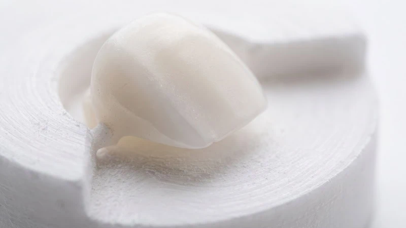 flawless zirconia crown margin precision